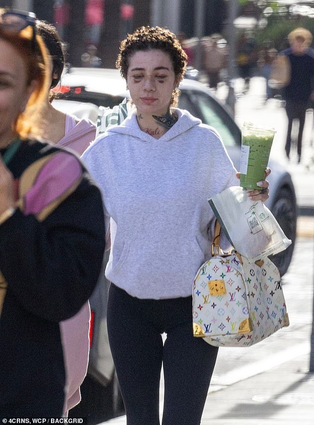 The social media personality seemed downcast amid her nose job recovery and cancer battle