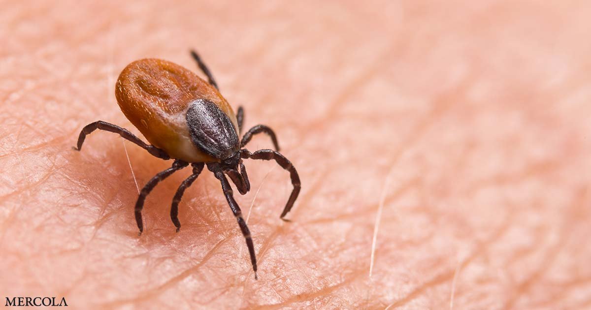 The Best and Worst Way to Remove a Tick